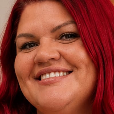 Emilie, Nurse Practitioner — Wound Management